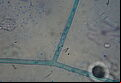 Thanatephorus cucumeris